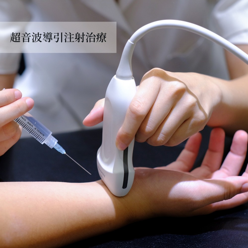 超音波導引注射
